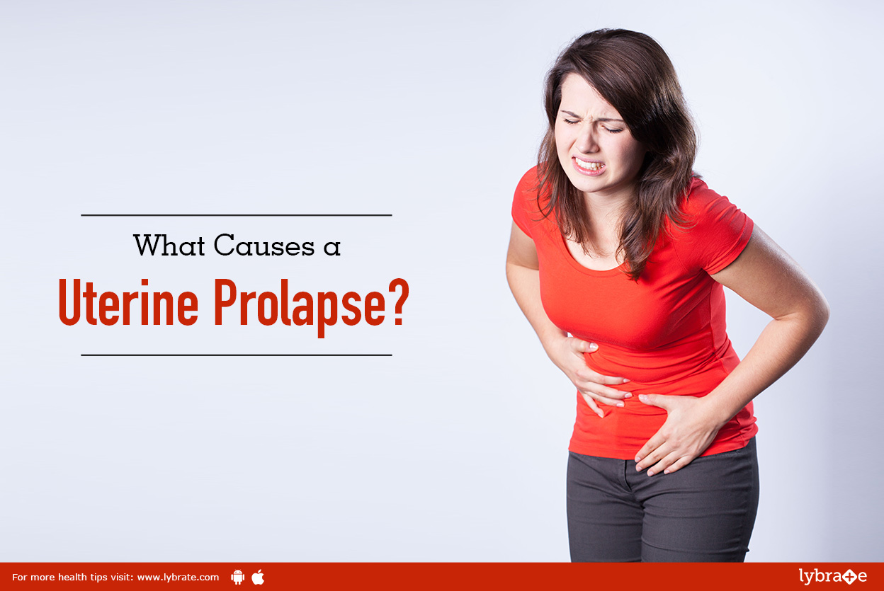 What Causes a Uterine Prolapse?
